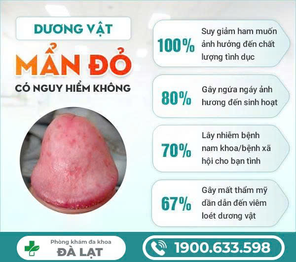 Hình ảnh minh họa